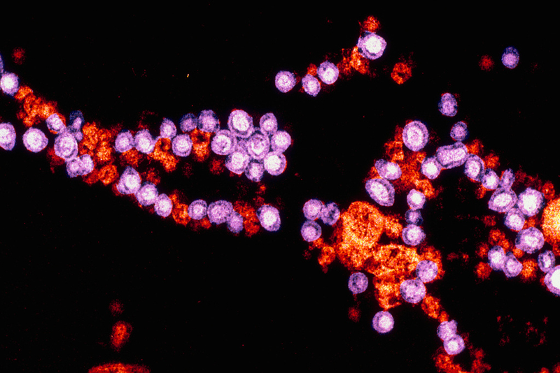 Illustration for article titled Psychedelic Images of Terrifying Viruses